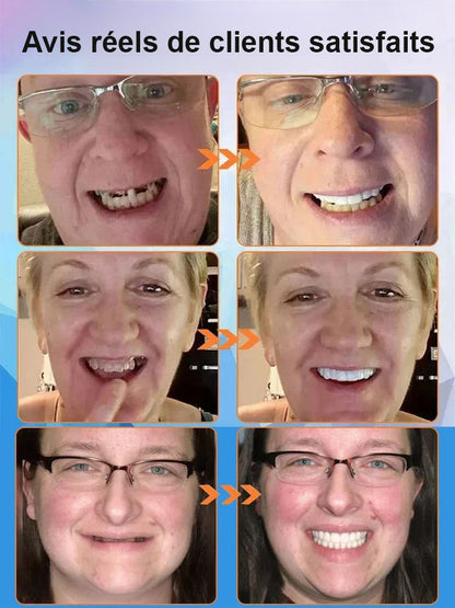 【Nouvelle découverte britannique】Appareil dentaire en silicone imitant les dents