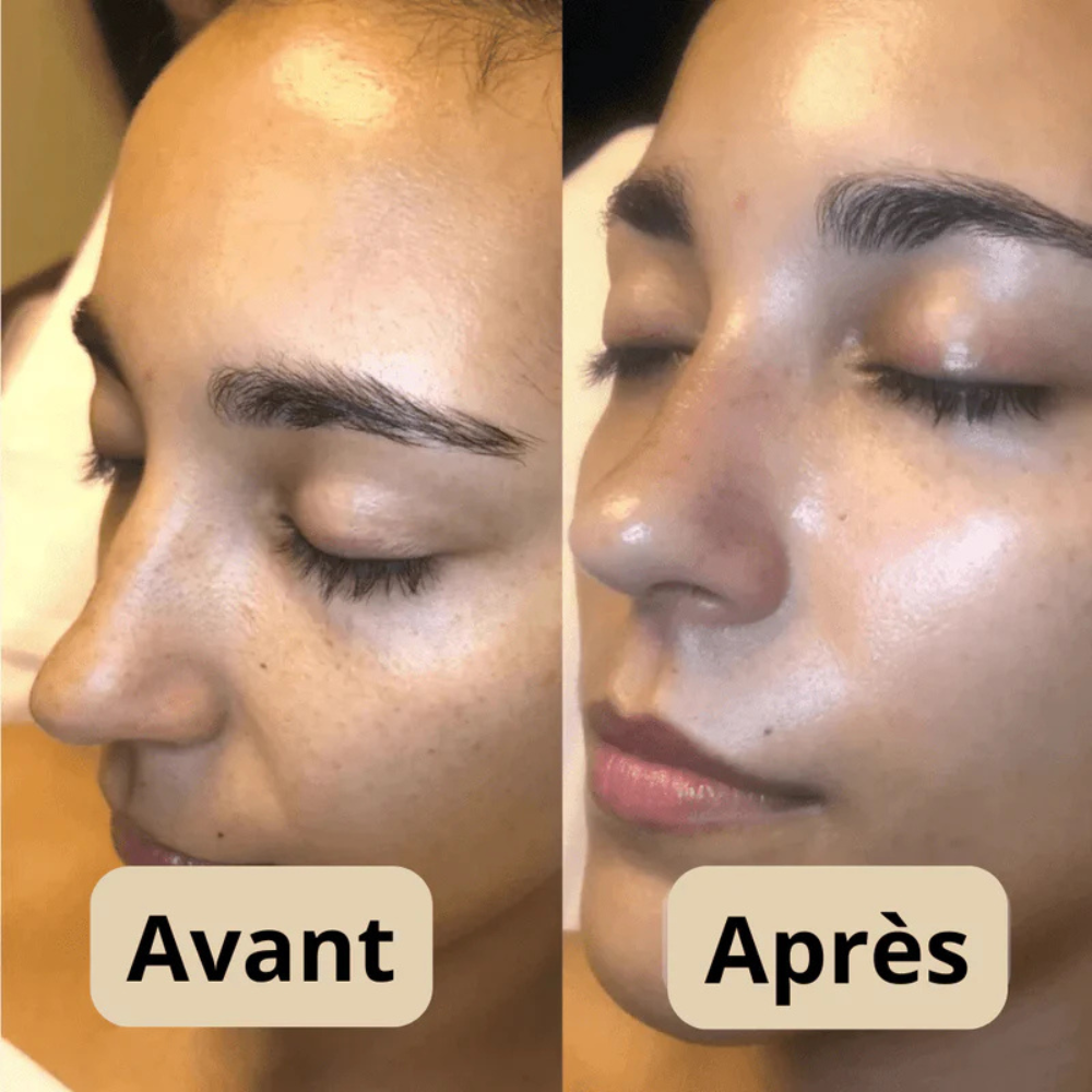 Peel shot Coréen  - Élimine les Impuretés et Sublime Votre Peau !
