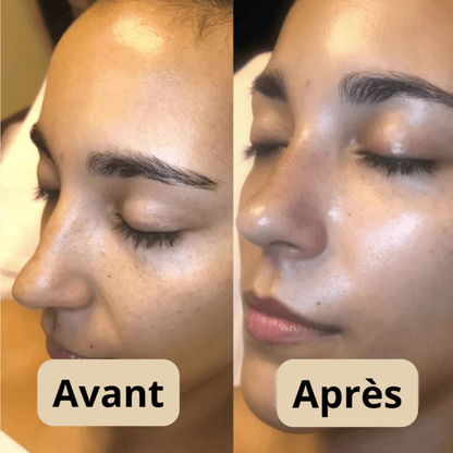Peel shot Coréen  - Élimine les Impuretés et Sublime Votre Peau !