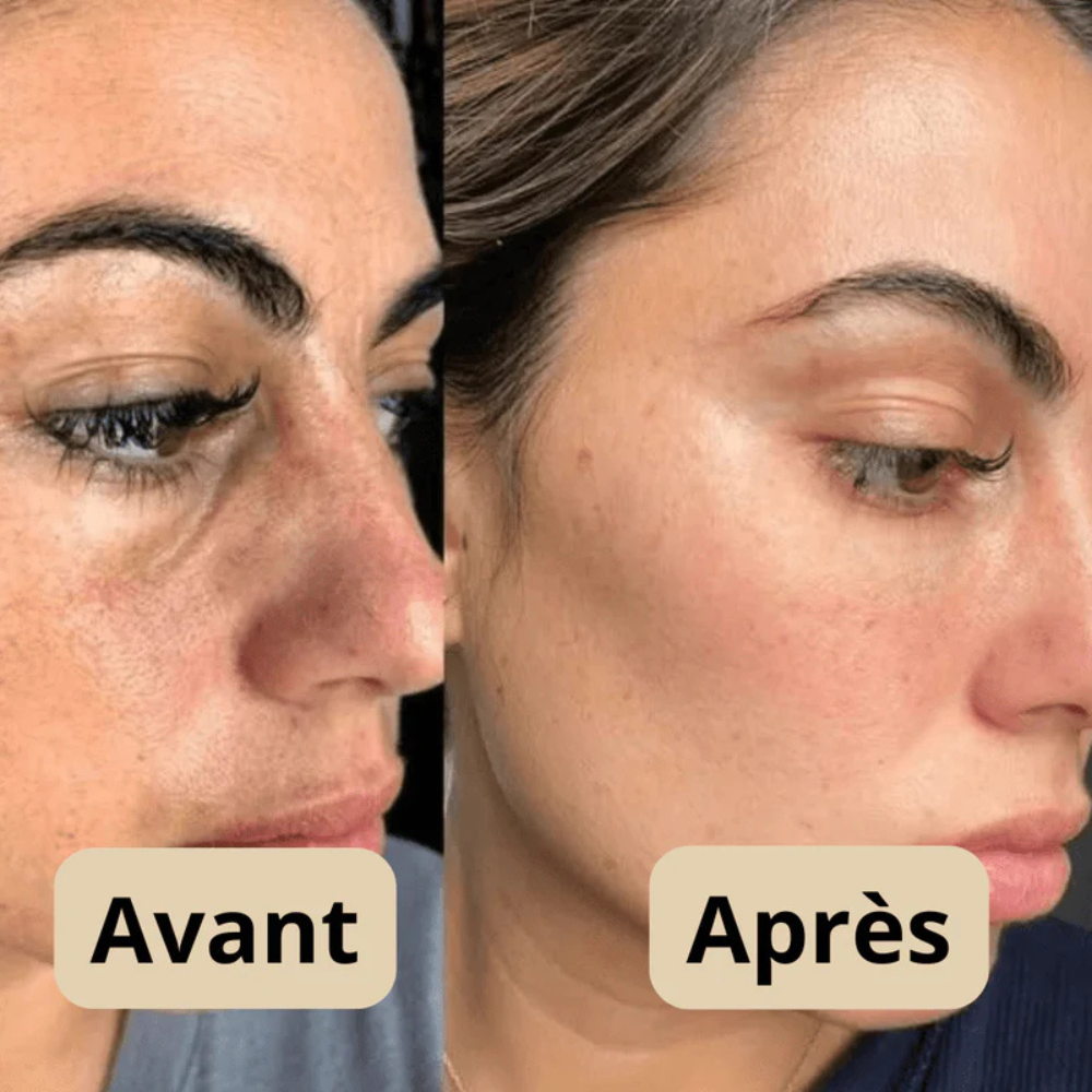 Peel shot Coréen  - Élimine les Impuretés et Sublime Votre Peau !