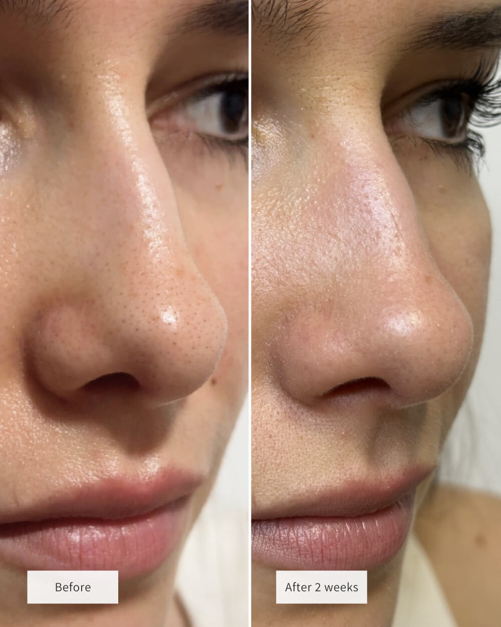 Pore Clear : Adieu Points Noirs en une Nuit